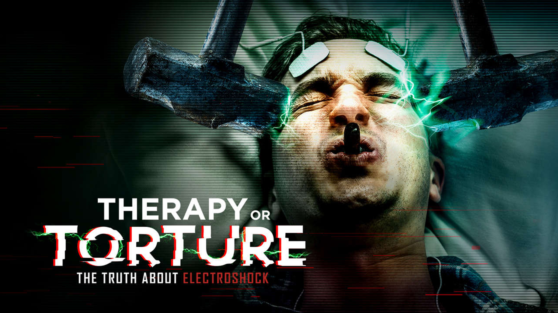 Therapy or Torture - The Truth About Electroshock