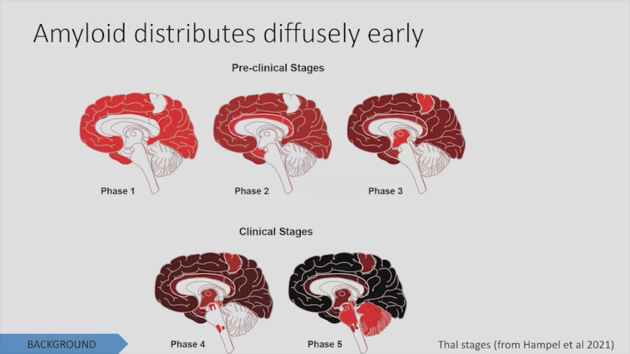 Can We Avoid Cognitive Decline with Age?